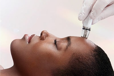 Sirius Med Spa DiamondGlow facial