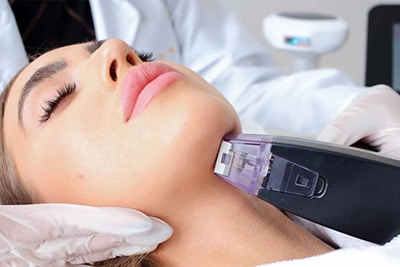 Sirius Med Spa Morpheus8 Microneedling